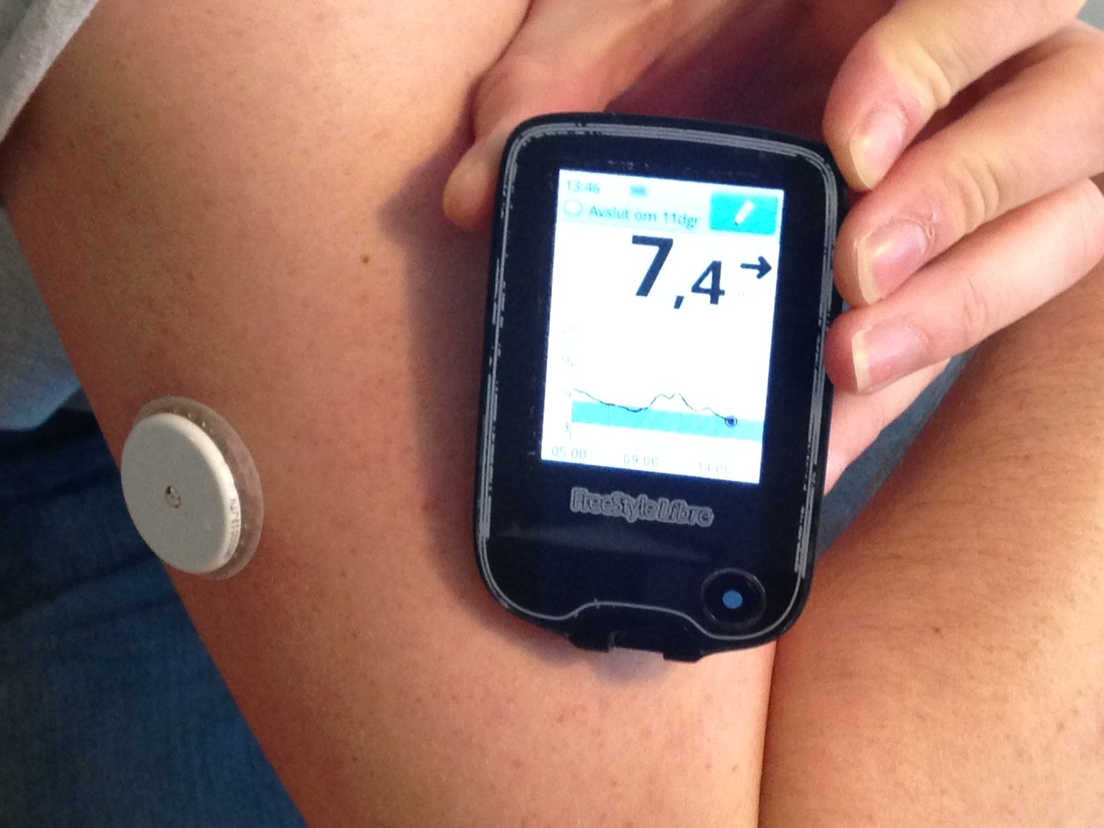 Practical use of continuous glucose monitoring for athletes